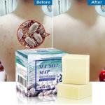 Savons à la glycérine anti acné hydratants texture lait 